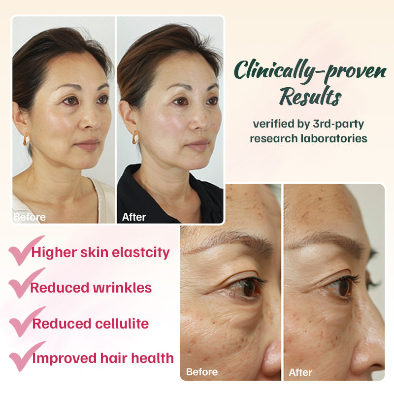 The Skin Plan - Helps Reduce Wrinkles